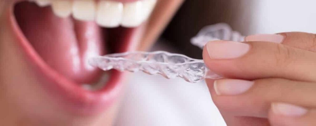 Dental Night Guard Smile LA 1200x480