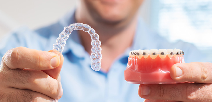 man holding clear aligner in one hand and a mout mouth with braces in the other