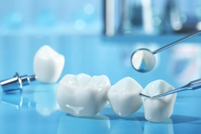 All Ceramic Crowns