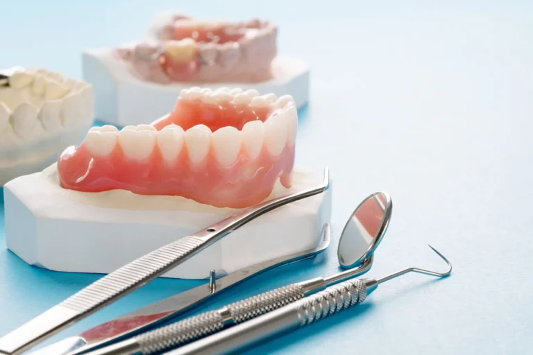 Implant Supported Dentures