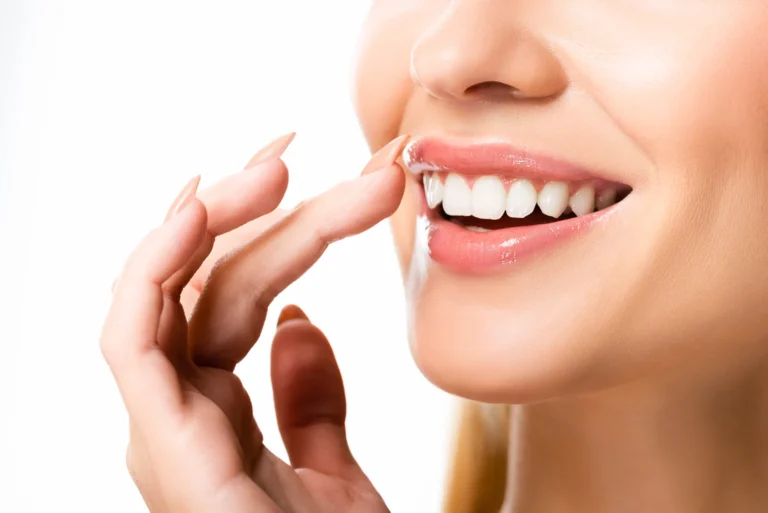 Porcelain Veneers