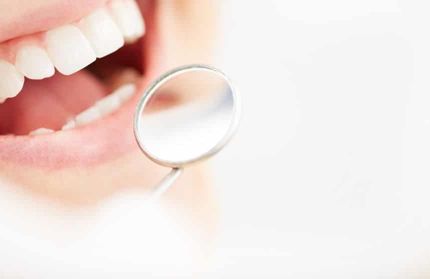 Dental mirror held beside a patient's open mouth
