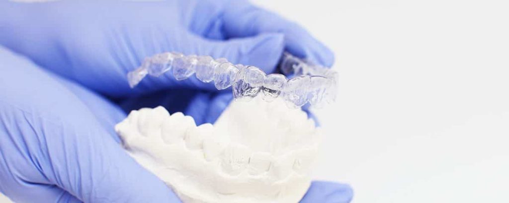 Gloved hands fitting a clear aligner onto a plaster model of the teeth