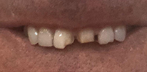 Smile LA case 07, before treatment