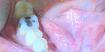 Smile LA case 08, before treatment