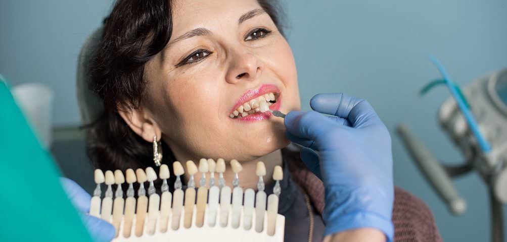 Dentist holding a tooth shade guide against a patient's teeth