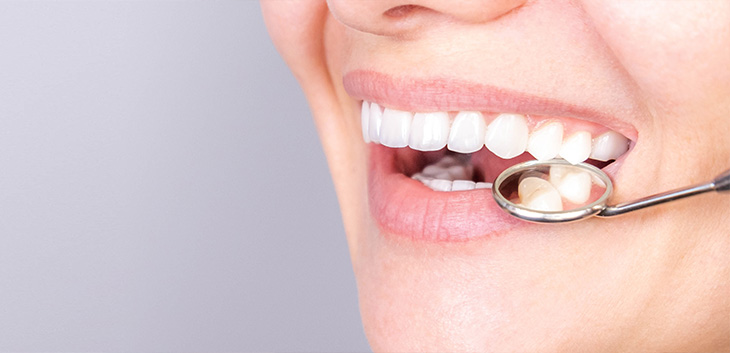 Dental mirror reflecting a person's teeth
