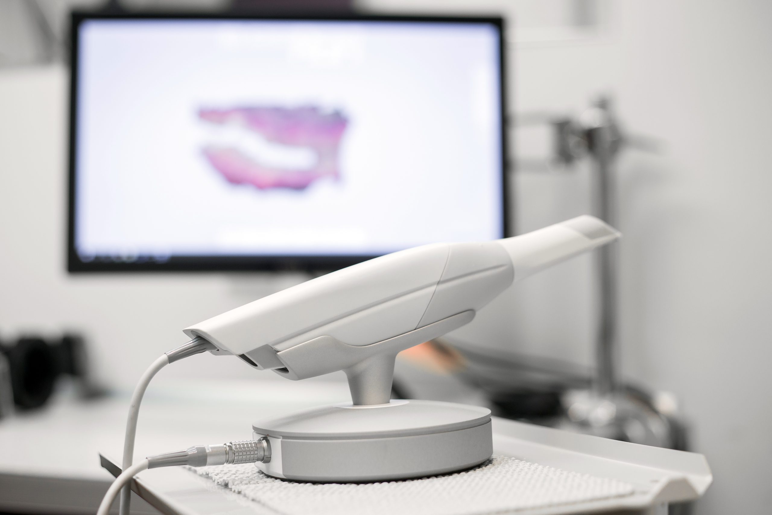 An iTero scanner wand on its stand beside a 3D scan of a patient on screen
