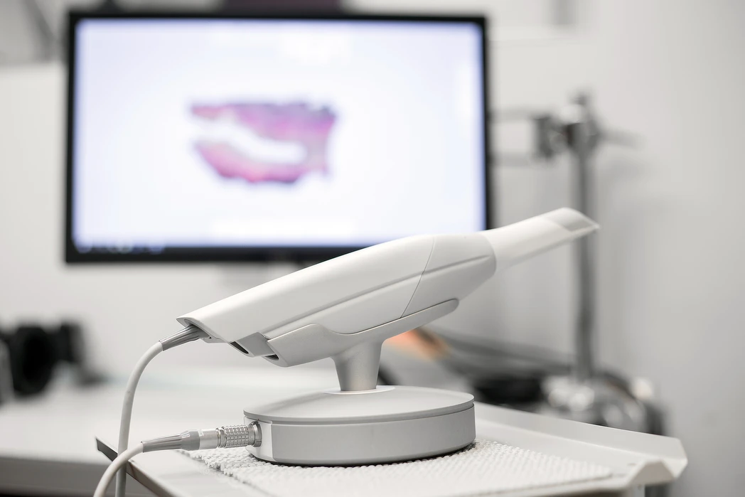 An iTero digital scanner with a 3D scan of a dental arch on its screen