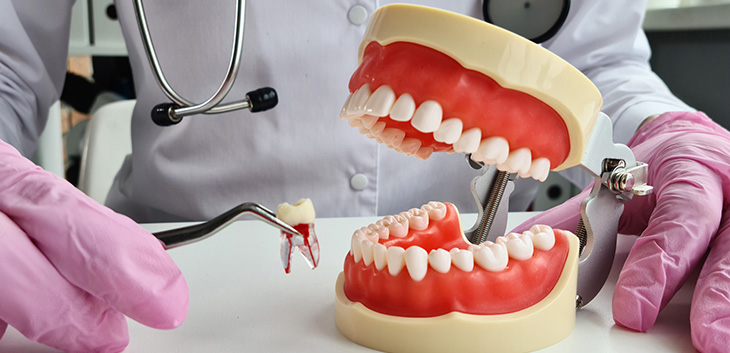 Tooth held in forceps beside a model of a mouth