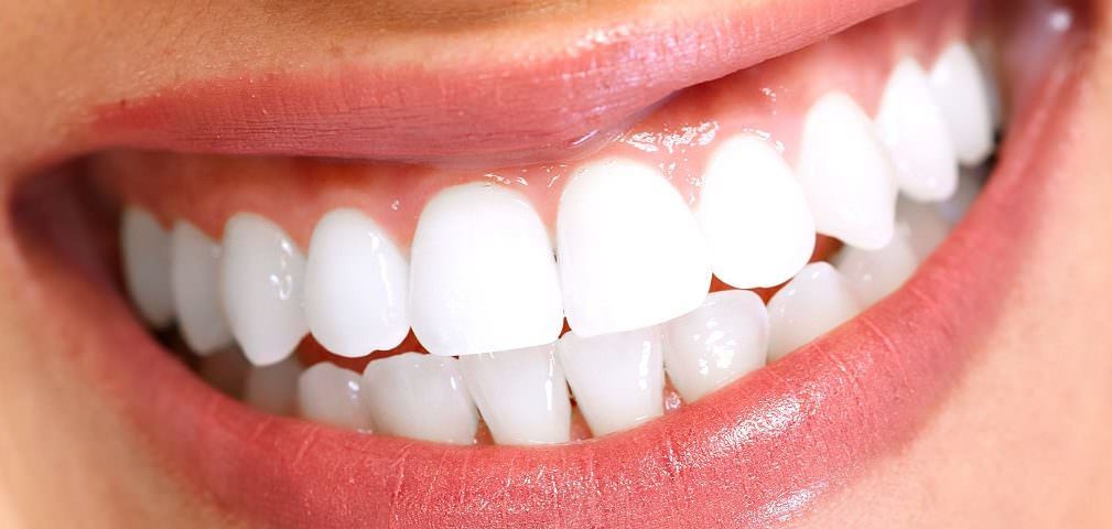 Close-up of a bright white smile