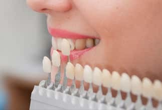 Tooth shade guide held up against a patient's smile